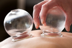 cupping-teraphy